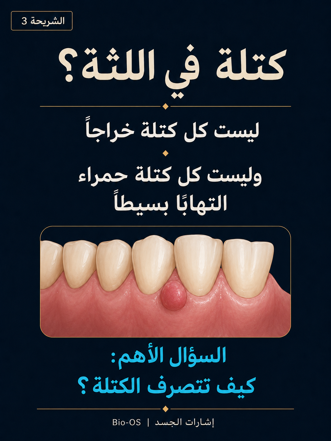 كتلة في اللثة؟ — الشريحة 4