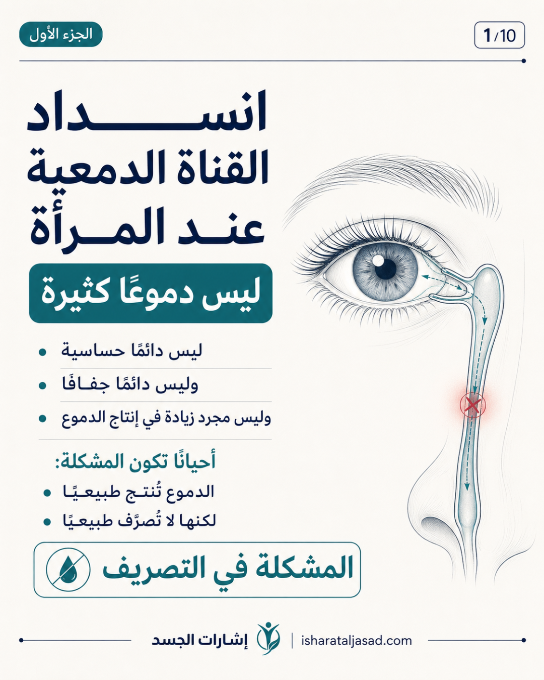 انسداد القناة الدمعية عند المرأة ليس دموعًا كثيرة فقط — الشريحة 2