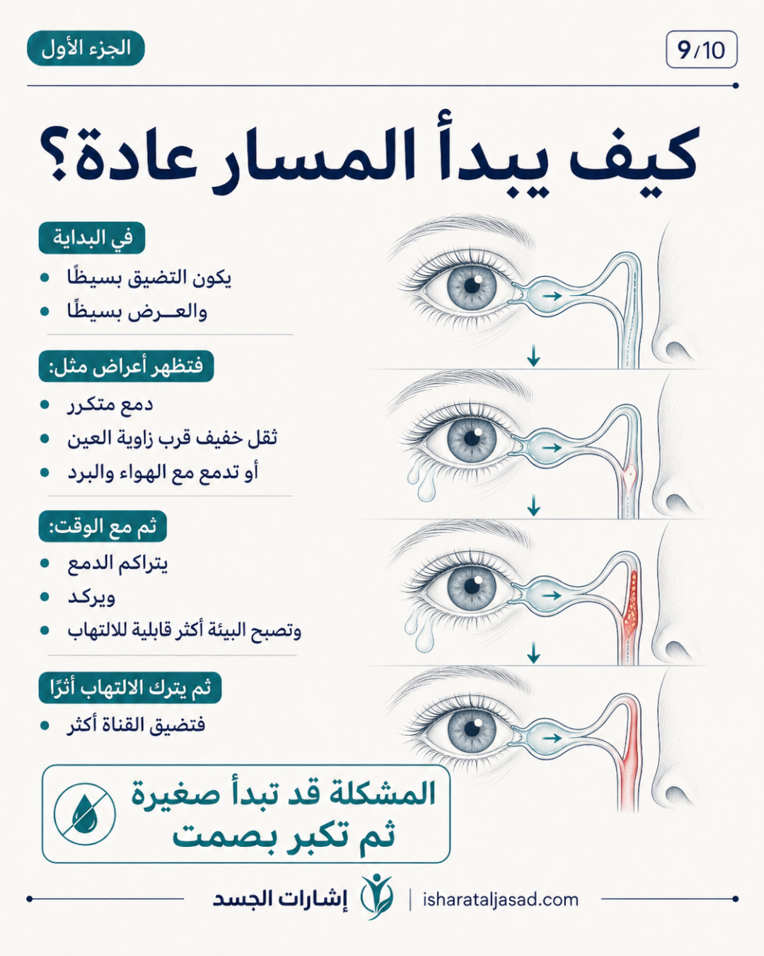انسداد القناة الدمعية عند المرأة ليس دموعًا كثيرة فقط — الشريحة 10