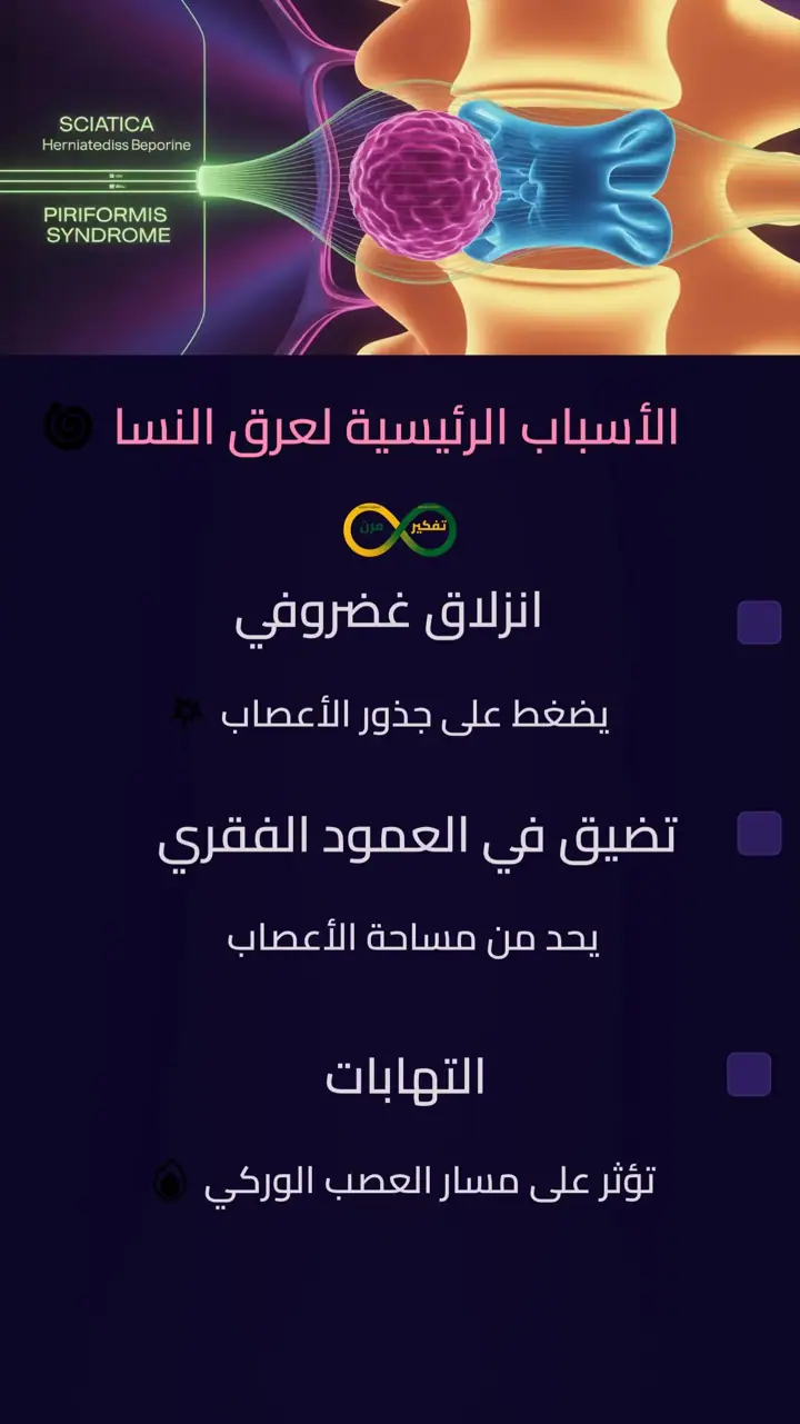 الشريحة 4 من 12: متلازمة عصب وركي وعرق نساء