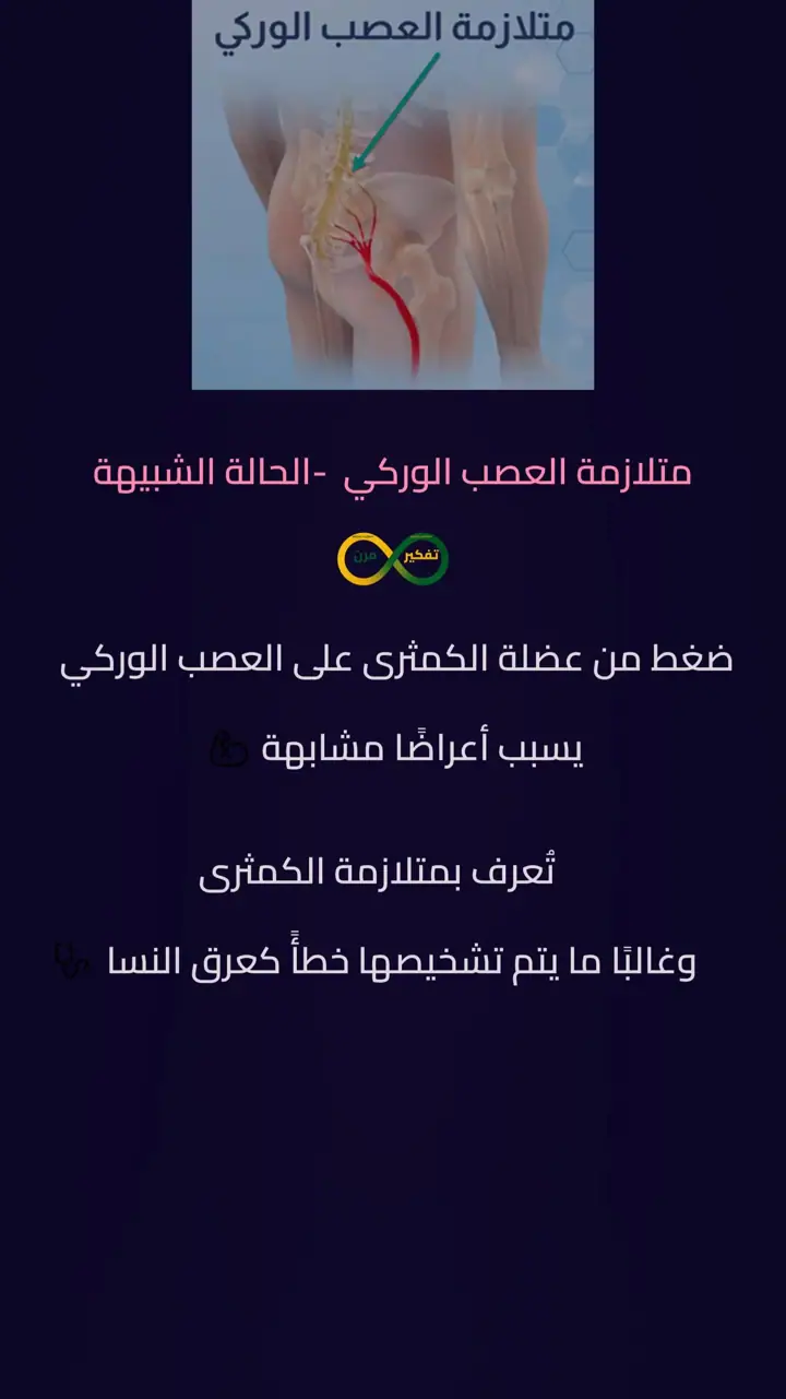 الشريحة 6 من 12: متلازمة عصب وركي وعرق نساء