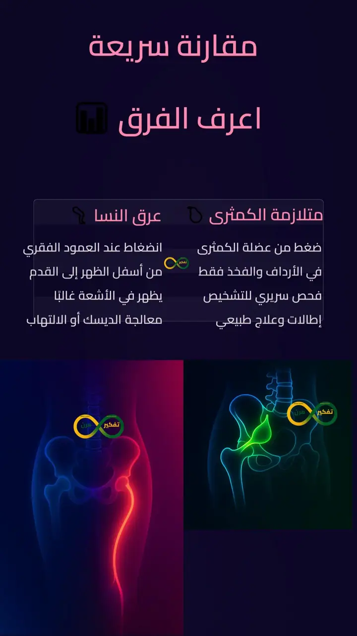 الشريحة 8 من 12: متلازمة عصب وركي وعرق نساء