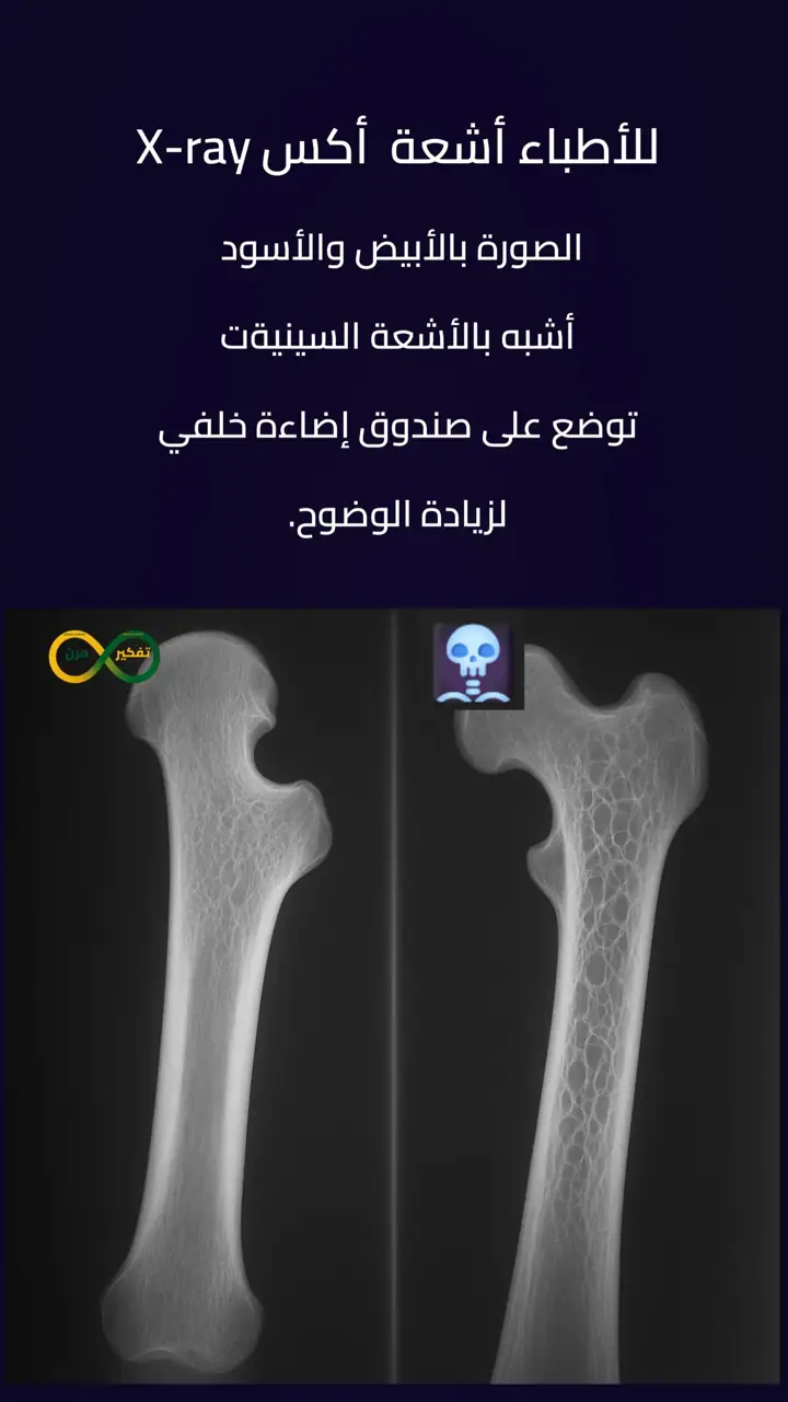 الشريحة 3 من 13: هشاشة العظام ليست قدرك… بل خطة شفاء متكاملة