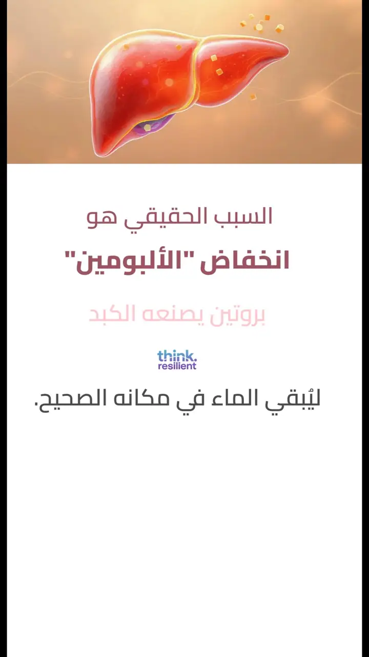 الشريحة 3 من 12: تورم في القدمين