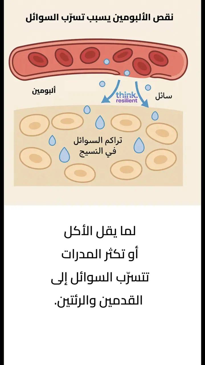 الشريحة 5 من 12: تورم في القدمين