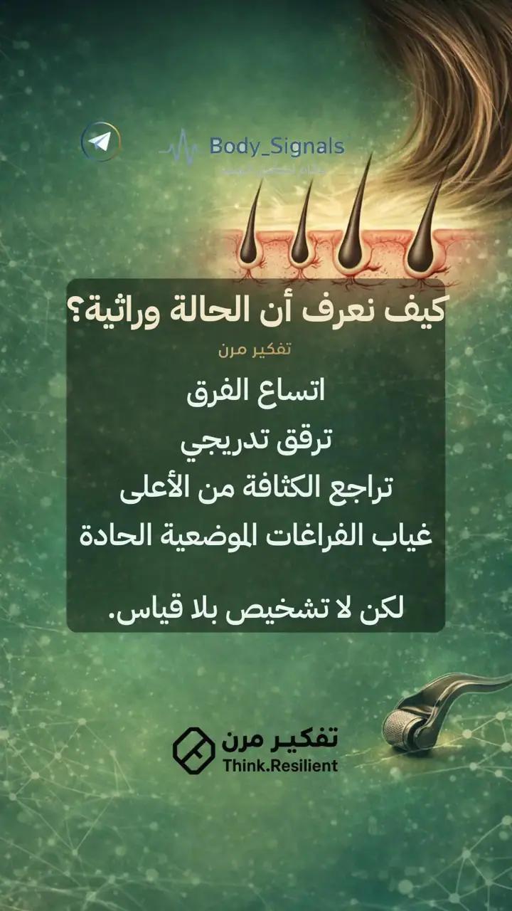 الشريحة 4 من 19: تساقط الشعر الوراثي عند النساء لا يُهزم بمنتج
