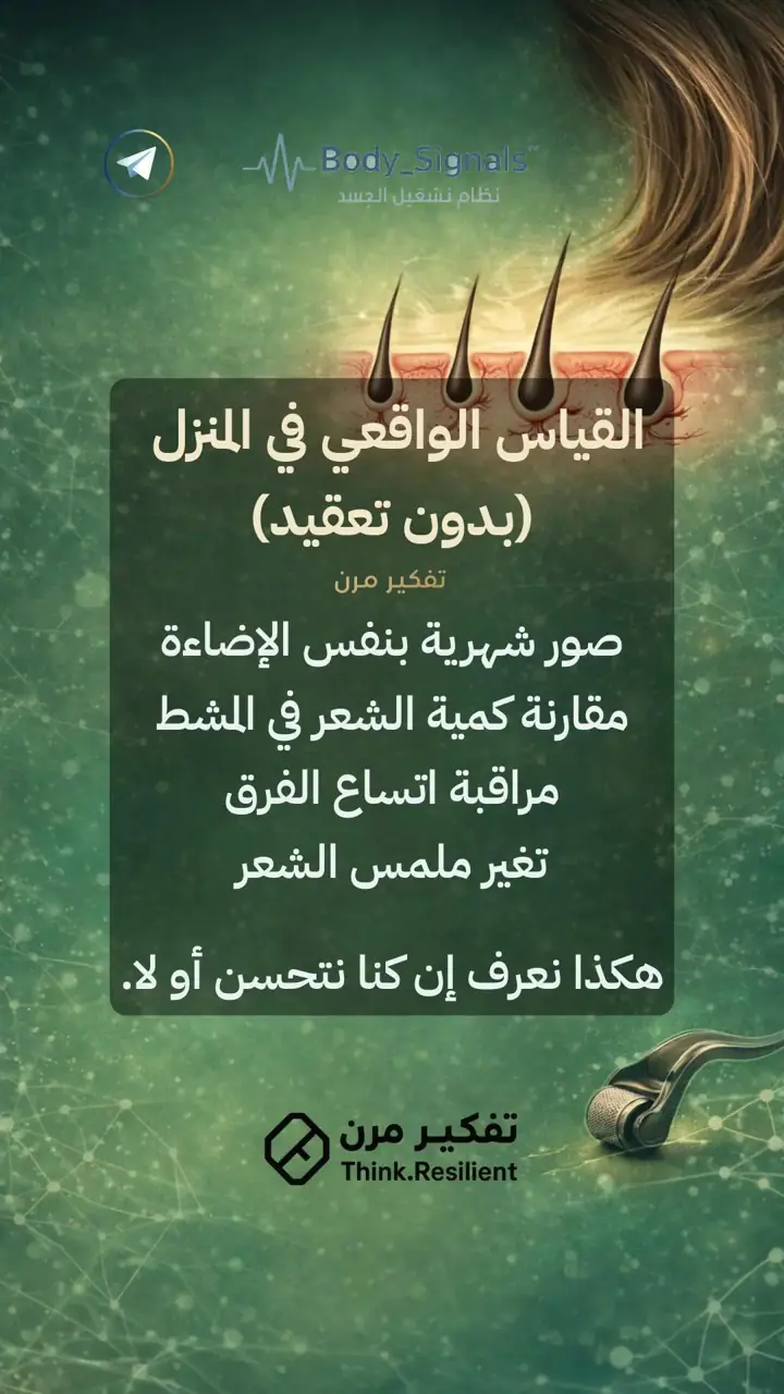 الشريحة 5 من 19: تساقط الشعر الوراثي عند النساء لا يُهزم بمنتج