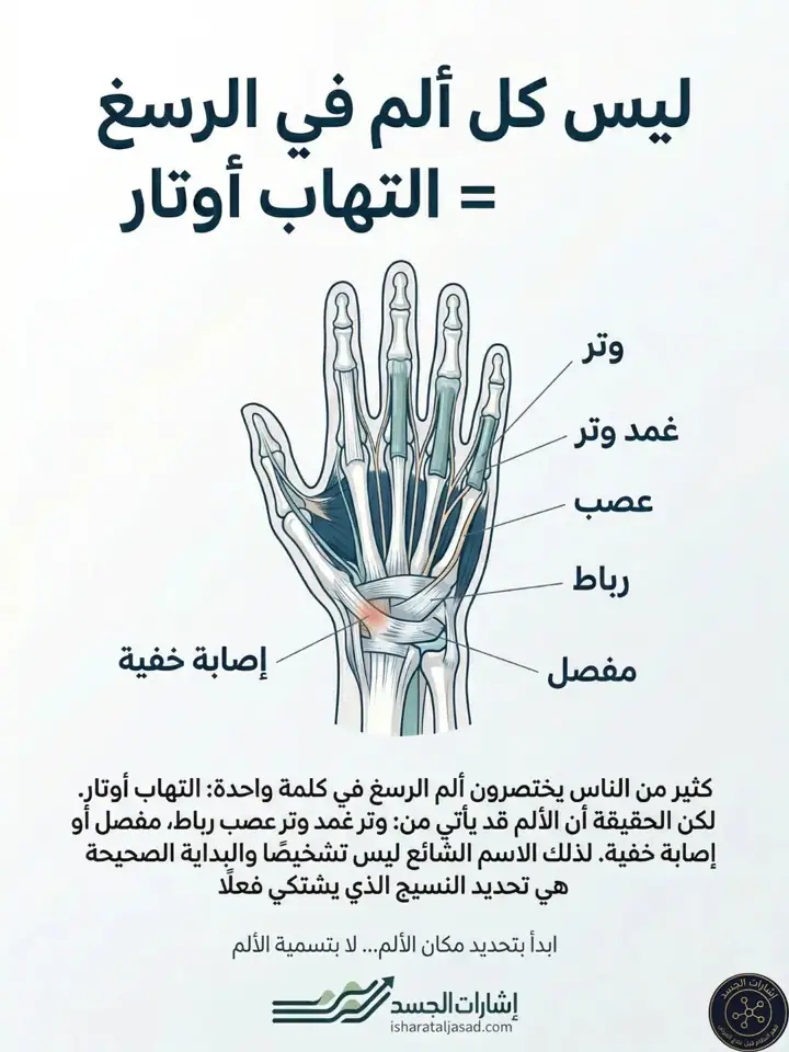 الشريحة 1 من 10: ليس كل ألم في الرسغ التهاب أوتار