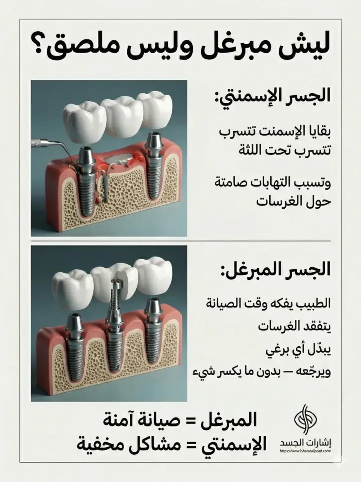 الشريحة 6 من 14: نظام المضغ بالكامل