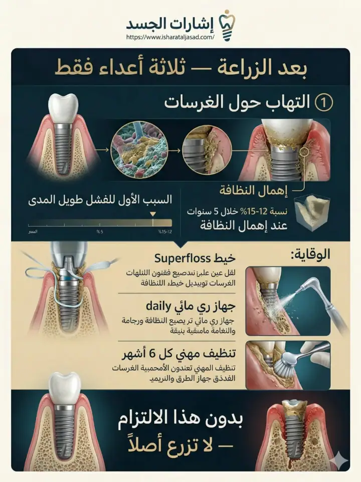 الشريحة 9 من 14: نظام المضغ بالكامل
