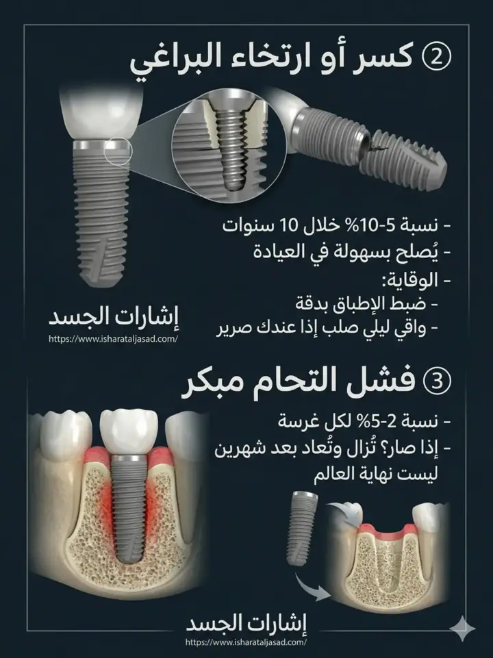 الشريحة 10 من 14: نظام المضغ بالكامل