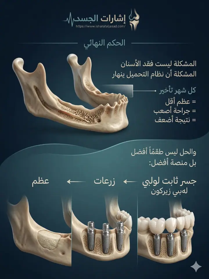 الشريحة 13 من 14: نظام المضغ بالكامل