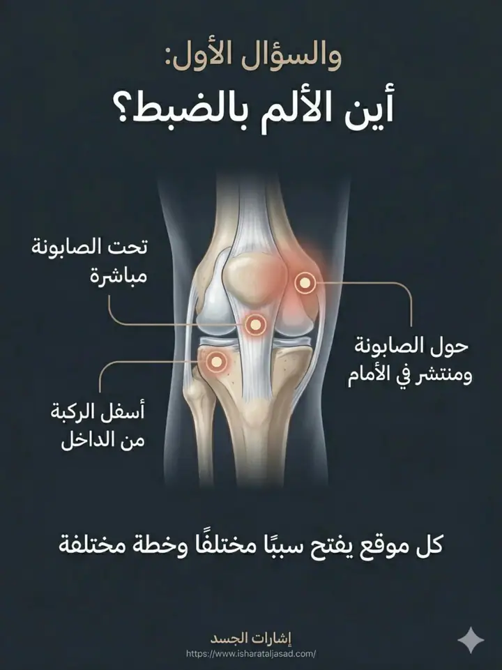 الشريحة 4 من 20: ألم ما تحت الركبة