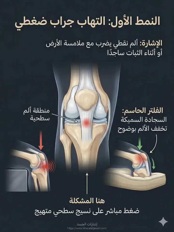 الشريحة 7 من 20: ألم ما تحت الركبة