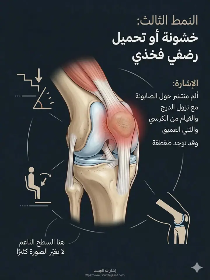الشريحة 9 من 20: ألم ما تحت الركبة