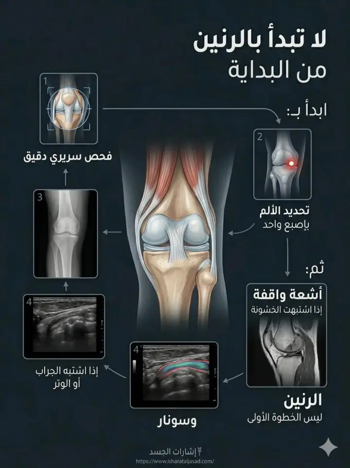 الشريحة 15 من 20: ألم ما تحت الركبة