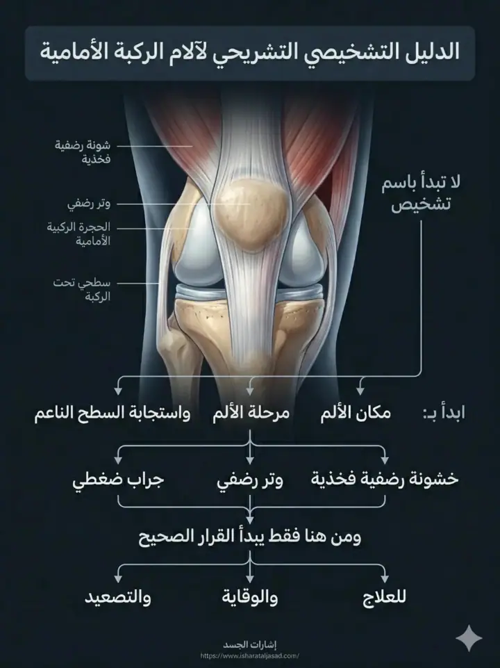 الشريحة 19 من 20: ألم ما تحت الركبة