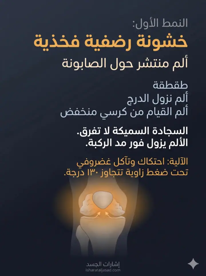 الشريحة 8 من 27: ألم ما تحت الركبة