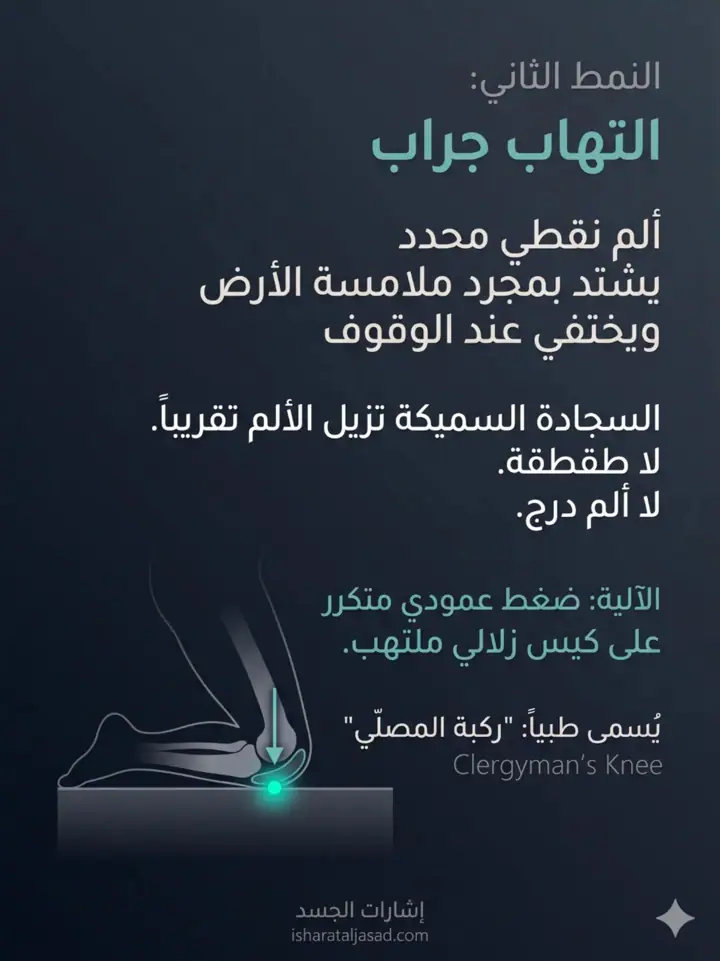 الشريحة 9 من 27: ألم ما تحت الركبة