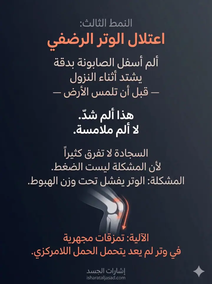 الشريحة 10 من 27: ألم ما تحت الركبة