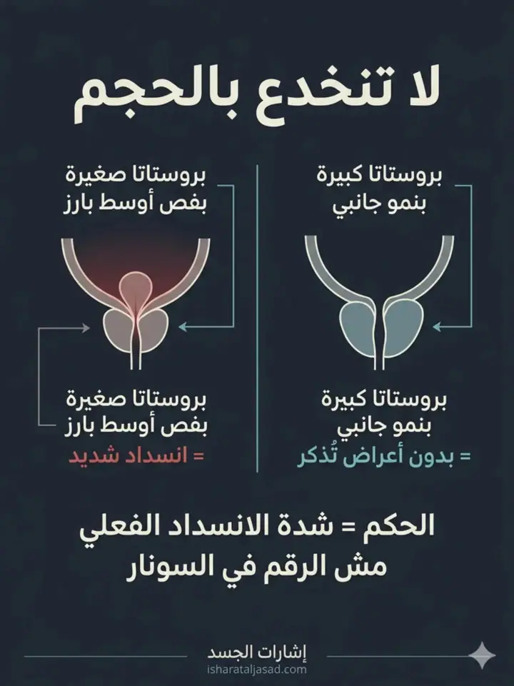 الشريحة 4 من 22: البروستاتا: من الإشارات إلى لحظة التدخل