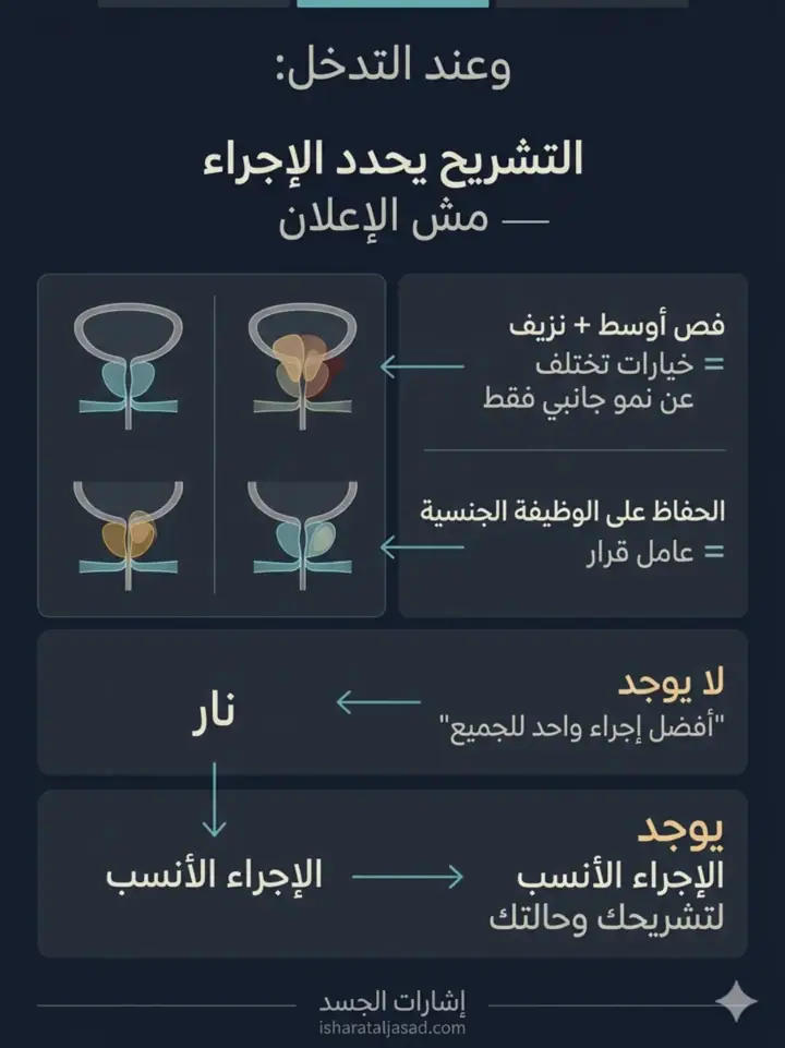 الشريحة 14 من 22: البروستاتا: من الإشارات إلى لحظة التدخل