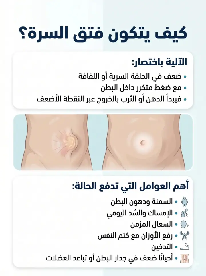 الشريحة 3 من 18: فتق السرة المتوسط عند البالغين