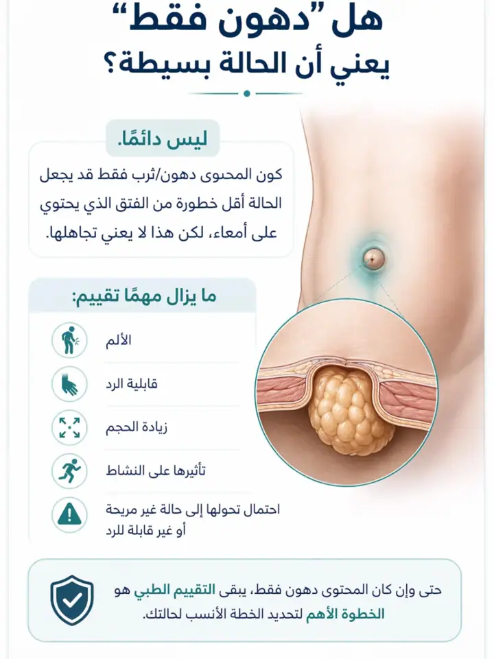الشريحة 4 من 18: فتق السرة المتوسط عند البالغين