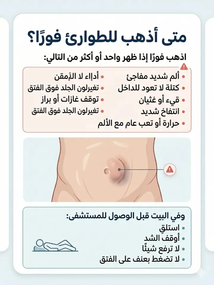 الشريحة 7 من 18: فتق السرة المتوسط عند البالغين