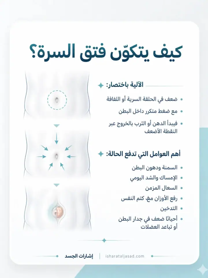 الشريحة 2 من 10: فتق السرة المتوسط عند البالغين: دليل مختصر