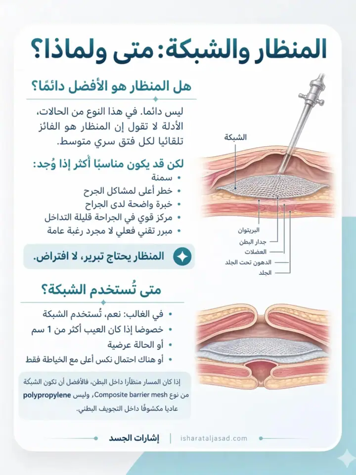 الشريحة 9 من 10: فتق السرة المتوسط عند البالغين: دليل مختصر