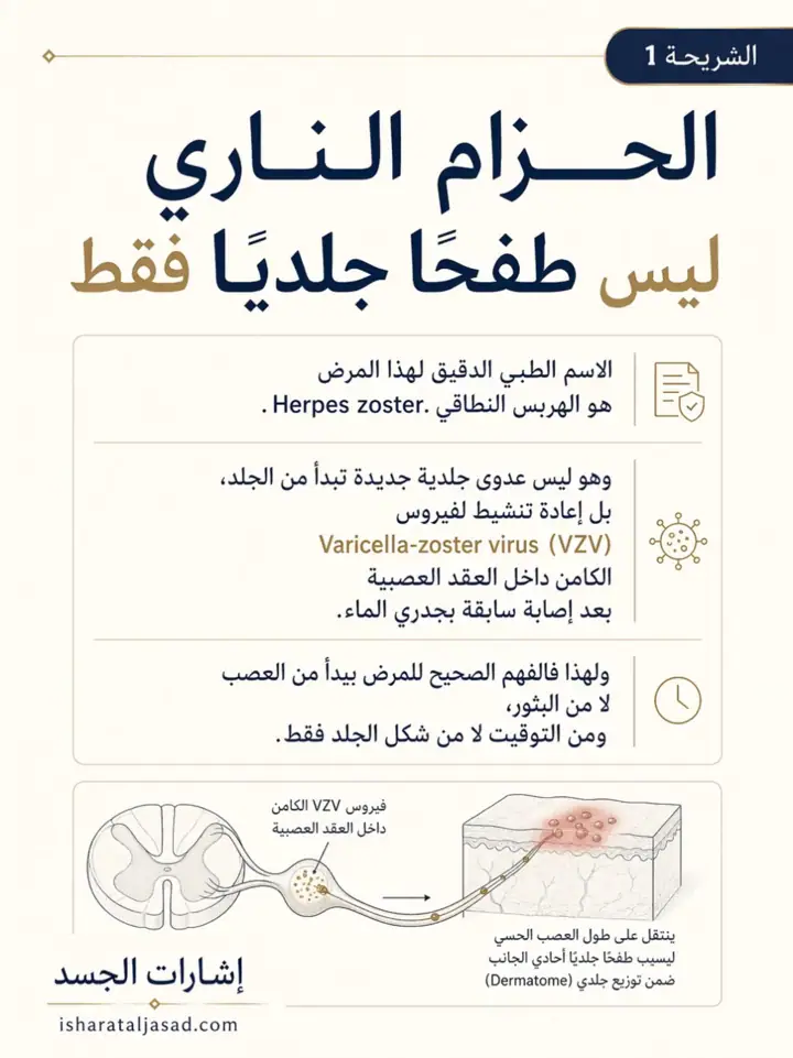 الشريحة 1 من 8: الحزام الناري ليس مجرد طفح جلدي