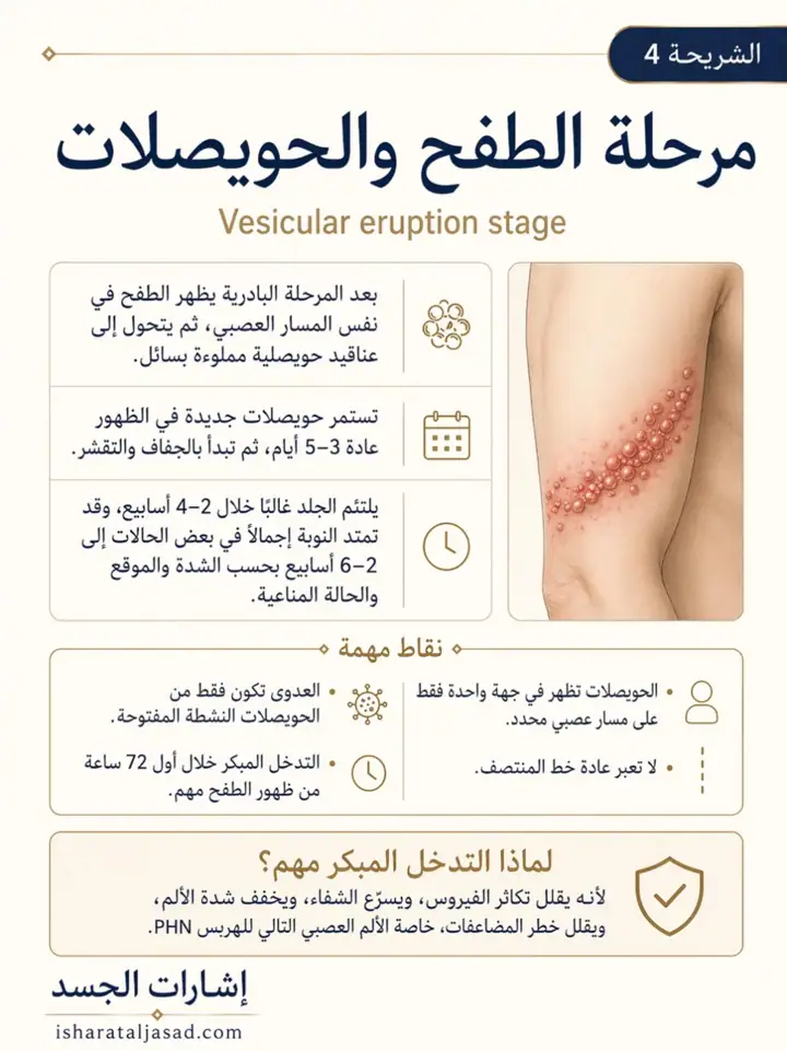 الشريحة 4 من 8: الحزام الناري ليس مجرد طفح جلدي