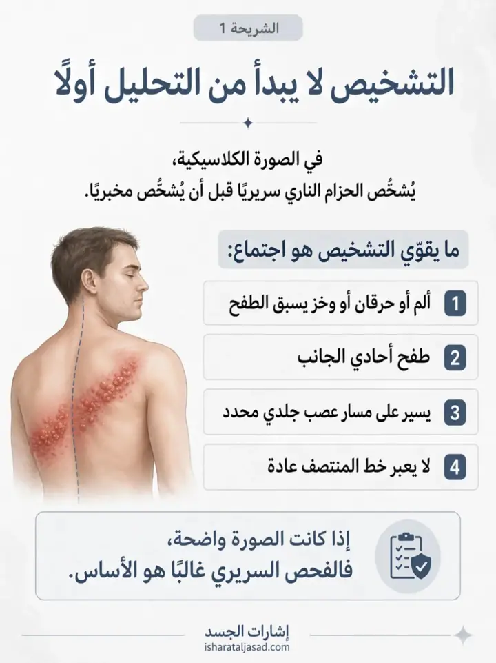 الشريحة 1 من 7: الحزام الناري