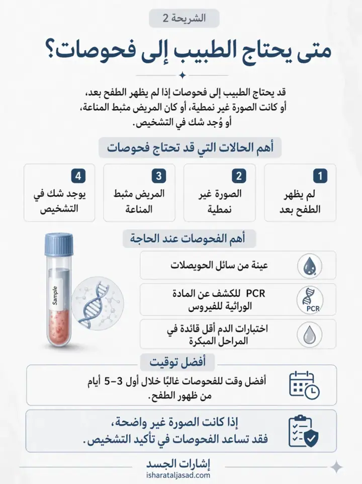 الشريحة 2 من 7: الحزام الناري
