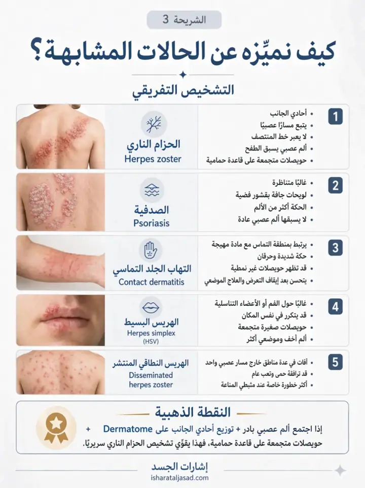 الشريحة 3 من 7: الحزام الناري