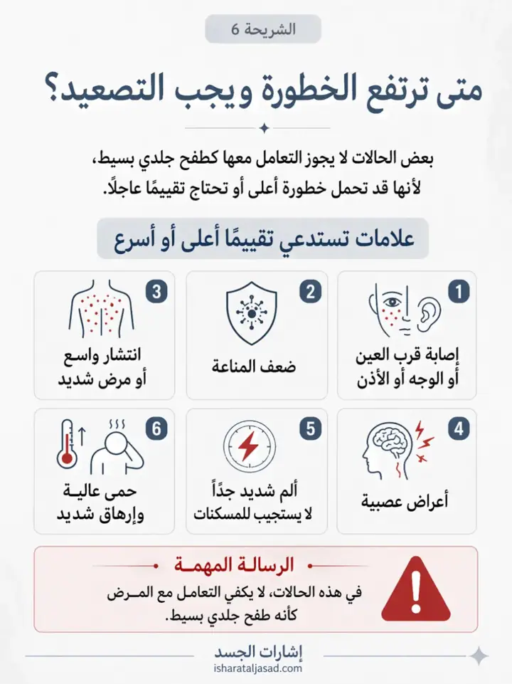 الشريحة 6 من 7: الحزام الناري