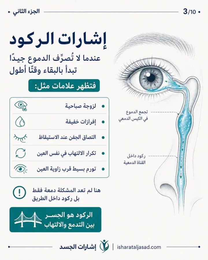 الشريحة 3 من 10: انسداد القناة الدمعية عند المرأة ليس دائمًا “حساسية” أو “جفاف”