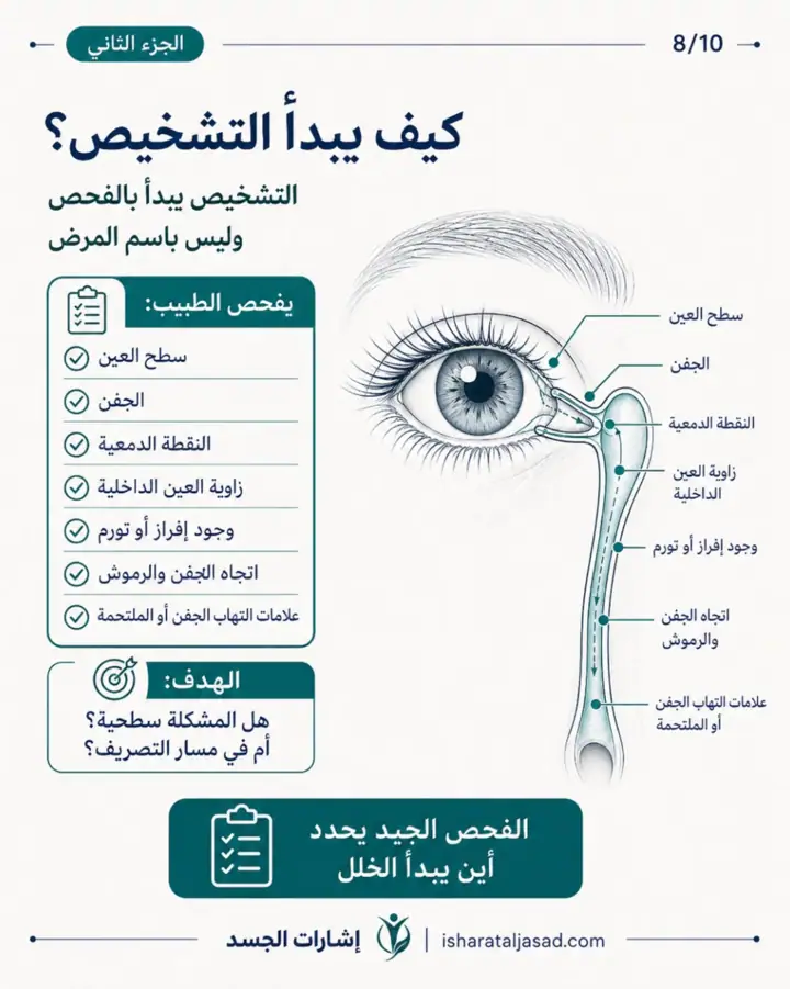الشريحة 8 من 10: انسداد القناة الدمعية عند المرأة ليس دائمًا “حساسية” أو “جفاف”