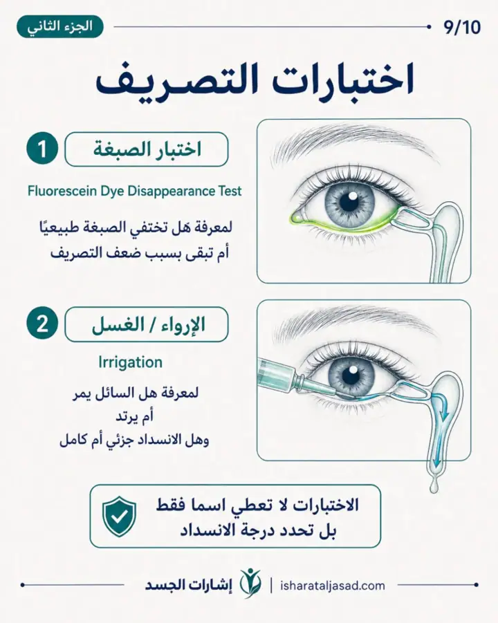 الشريحة 9 من 10: انسداد القناة الدمعية عند المرأة ليس دائمًا “حساسية” أو “جفاف”