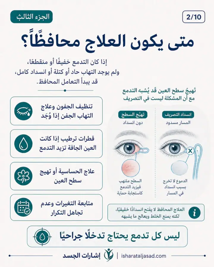 الشريحة 2 من 13: انسداد القناة الدمعية عند المرأة ليس دائمًا “حساسية” أو “جفاف”