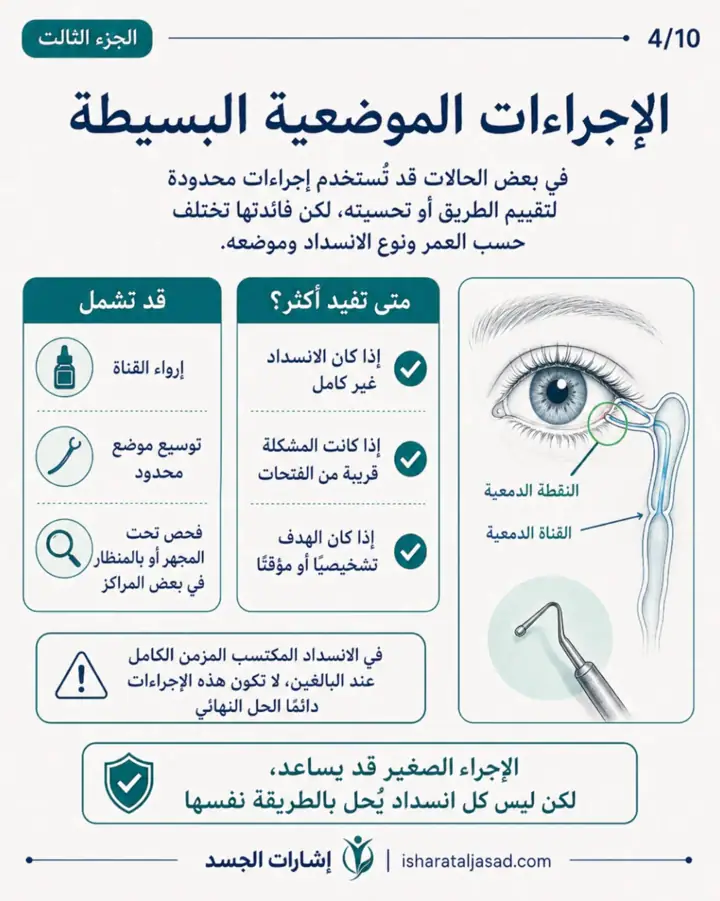 الشريحة 4 من 13: انسداد القناة الدمعية عند المرأة ليس دائمًا “حساسية” أو “جفاف”