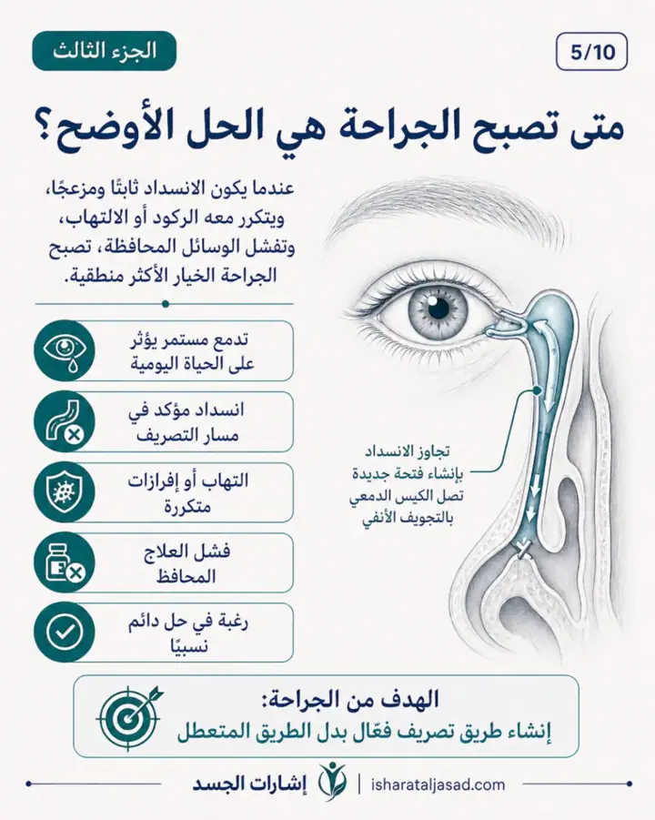 الشريحة 5 من 13: انسداد القناة الدمعية عند المرأة ليس دائمًا “حساسية” أو “جفاف”
