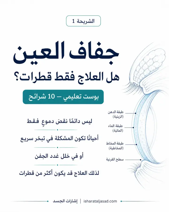 الشريحة 1 من 8: جفاف العين ليس دائمًا مشكلة تُحل بقطرة فقط
