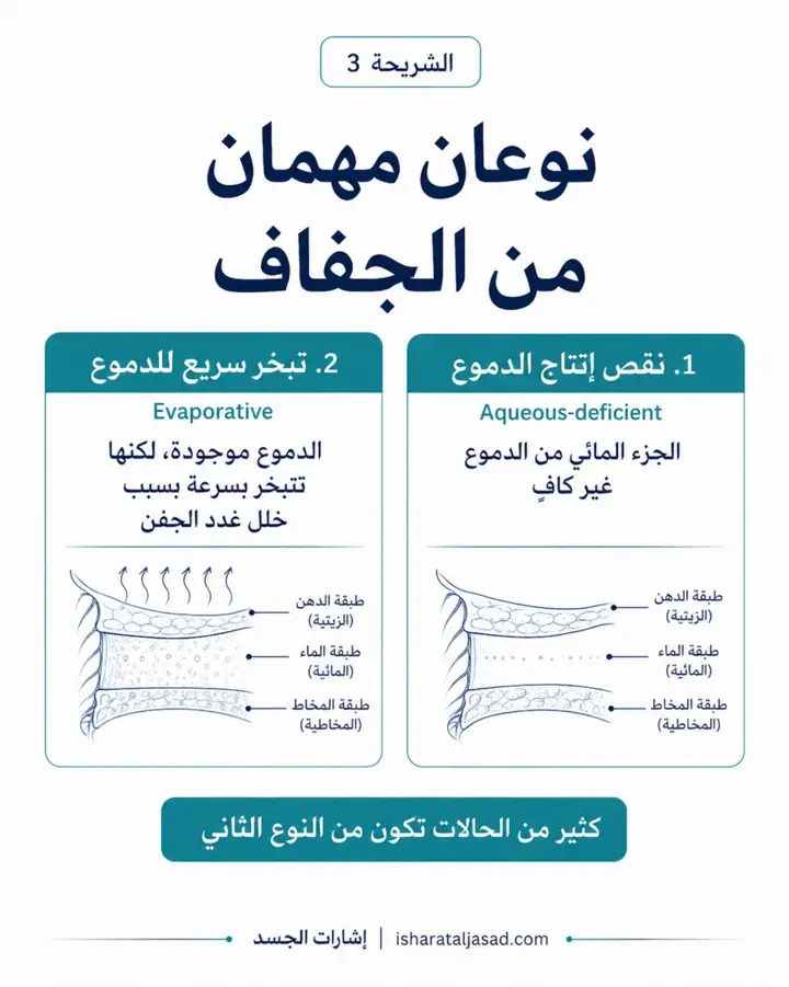 الشريحة 3 من 8: جفاف العين ليس دائمًا مشكلة تُحل بقطرة فقط