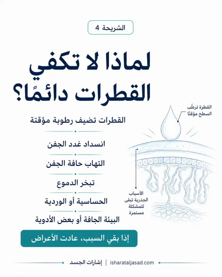 الشريحة 4 من 8: جفاف العين ليس دائمًا مشكلة تُحل بقطرة فقط