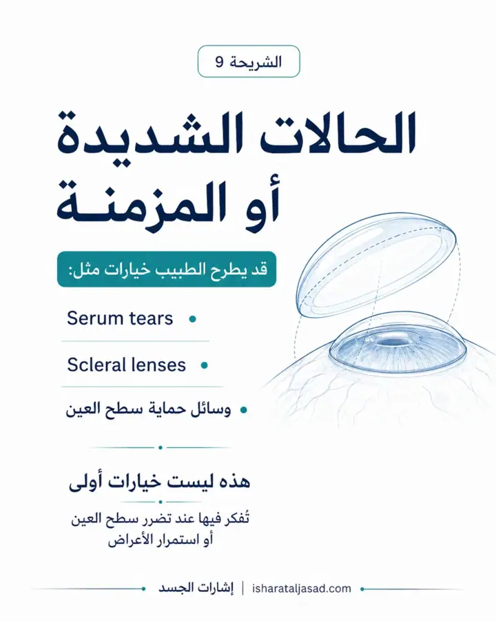 الشريحة 8 من 8: جفاف العين ليس دائمًا مشكلة تُحل بقطرة فقط
