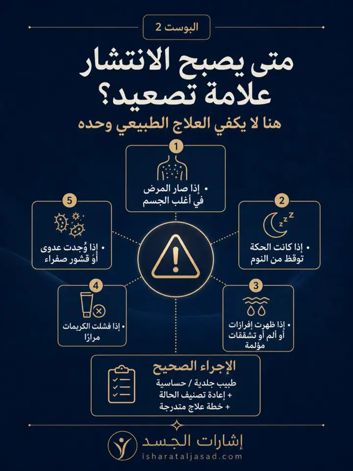الشريحة 7 من 10: الأكزيما المنتشرة: متى لا يكفي العلاج الطبيعي؟