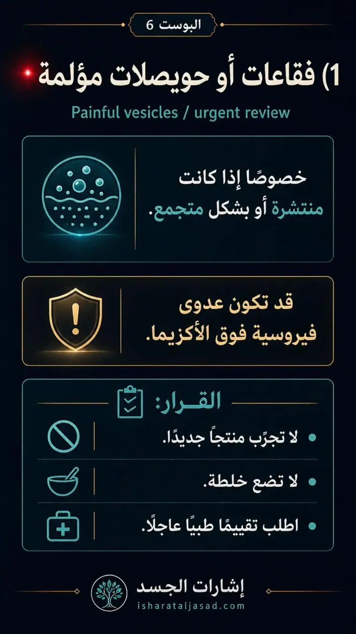 الشريحة 2 من 10: الإشارات الحمراء