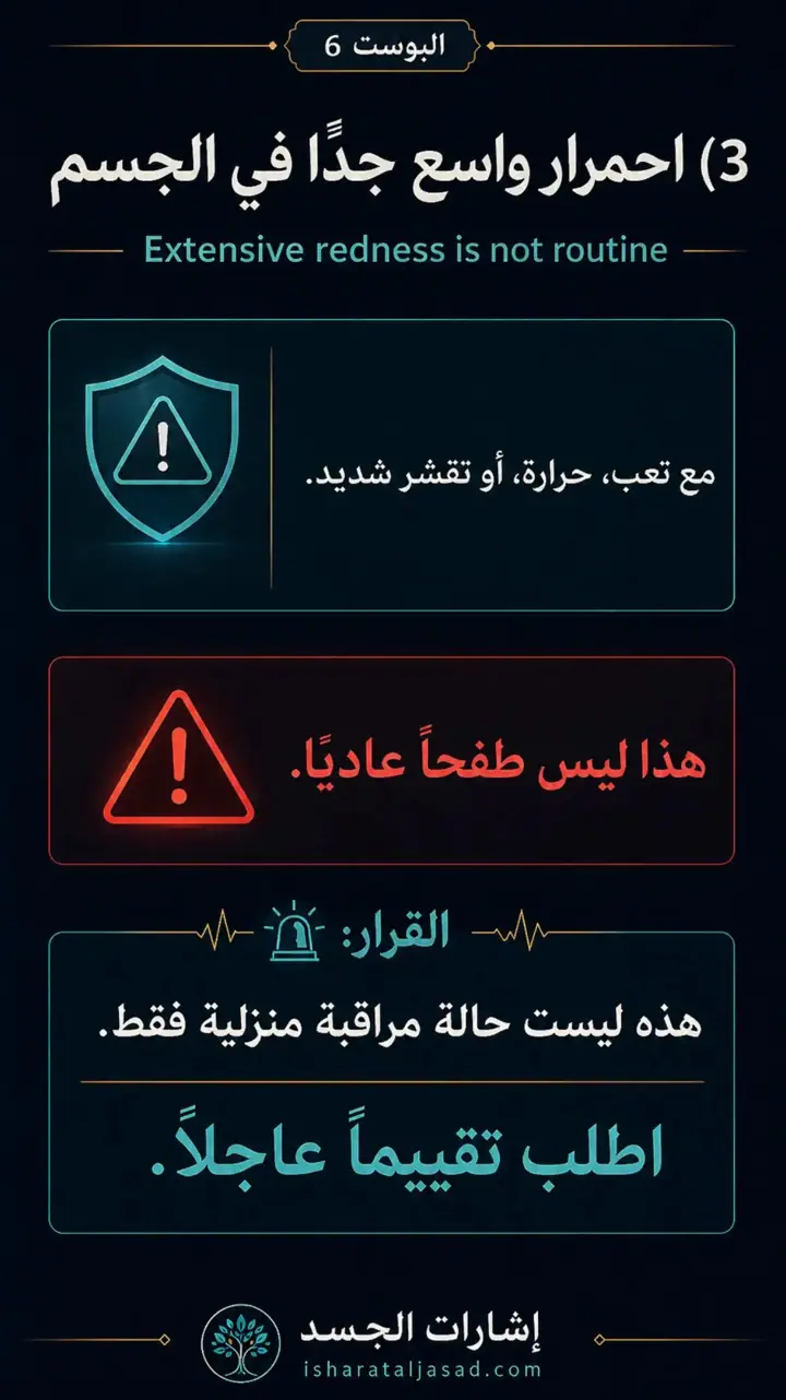 الشريحة 4 من 10: الإشارات الحمراء